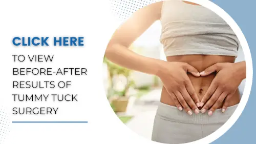 view-before-after-results-of-tummy-tuck-surgery