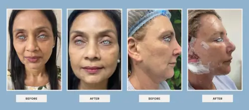 facial-procedures-before-after-1