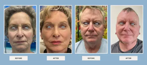 facial-procedures-before-after