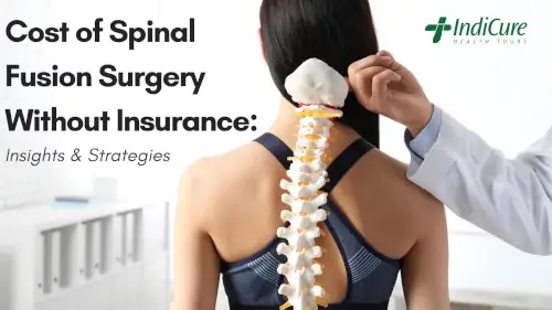Cost of Spinal Fusion Surgery Without Insurance