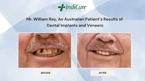 mr-william-ray-dental-treatment-before-after