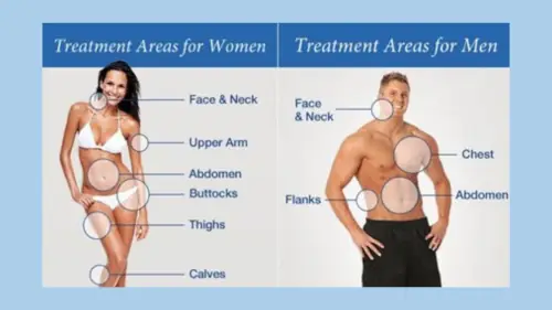 Multiple-Area Liposuction in India