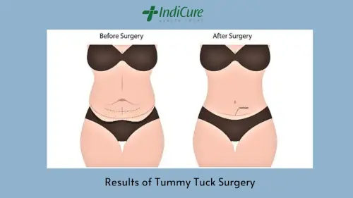 Results of Plastic Surgery in India