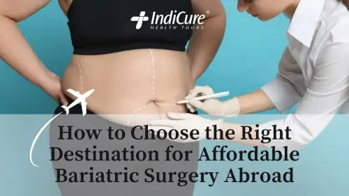 Right Destination for Affordable Bariatric Surgery Abroad