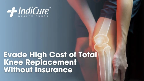 Total Knee Replacement Without Insurance Main Image